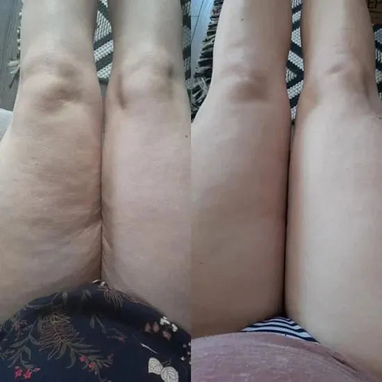 <h2><strong><br/>Before & After Stories: Why People Choose Us<br/></strong><br/></h2>